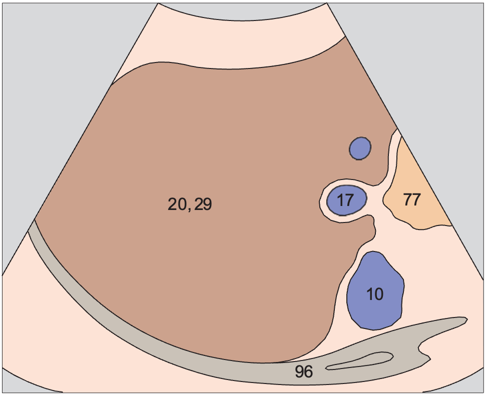 Posterior segment anatomy diagram, Posterior segment, portal vein