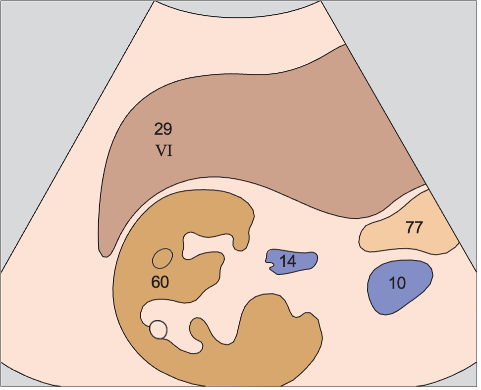 Posterior segment anatomy diagram, Posterior segment, caudal subsegment, kidney