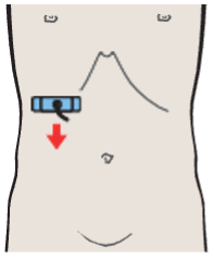Probe position, Posterior segment, inferior border