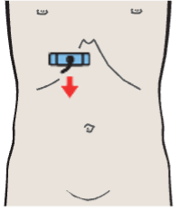 Probe position, Body of gallbladder
