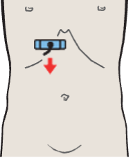 Probe position, Gallbladder fundus