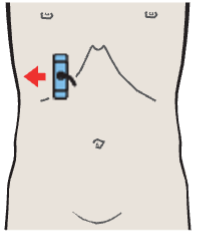 Probe position, Right portal vein branch, duodenum, gallbladder body