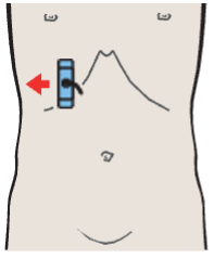 Probe position, Body and fundus of gallbladder, kidney