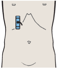 Probe position, Regions of the gallbladder, spiral folds