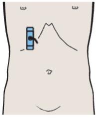 Probe position, Layers of the gallbladder wall