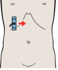 Probe position, Duodenum lateral to head of pancreas