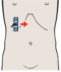 Probe position, Head of pancreas, bile duct