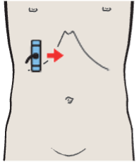 Probe position, Head of pancreas, hilar vessels, vena cava