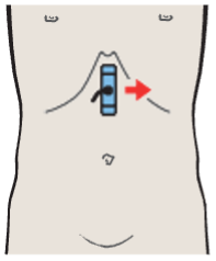 Probe position, Body of pancreas, splenic vein, superior mesenteric artery, aorta