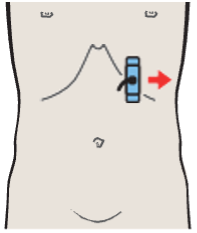 Probe position, Tail of pancreas, splenic artery and vein, renal artery and vein