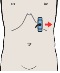 Probe position, Tail of pancreas, splenic artery and vein, renal artery and vein