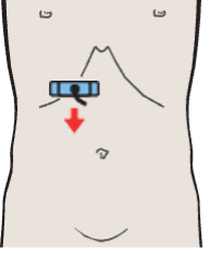 Probe position, Section cranial to head of pancreas, vena cava, splenic vein