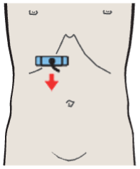 Probe position, Head of pancreas, vena cava, superior mesenteric vein