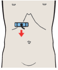 Probe position, Head of pancreas, vena cava, superior mesenteric vein, uncinate process, gallbladder