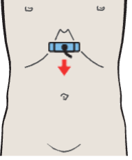 Probe position, Body of pancreas, splenic vein, superior mesenteric artery, aorta