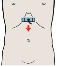 Probe position, Left renal artery and vein, superior mesenteric artery and vein, aorta