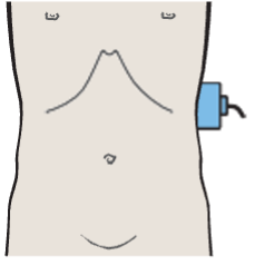 Probe position, Scan anterior to tail of pancreas, spleen, stomach