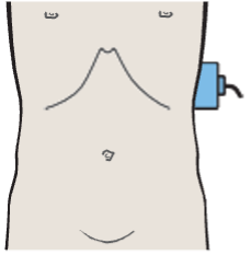 Probe position, Splenic hilum, splenic vein