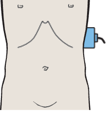 Probe position, Spleen, stomach