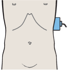 Probe position, Spleen, stomach