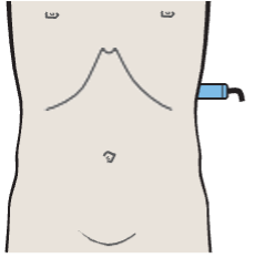 Probe position, Spleen, kidney, pancreas