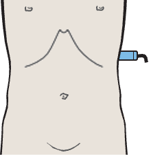 Probe position, Spleen, stomach