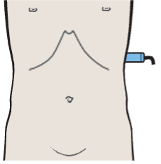 Probe position, Spleen, small bowel