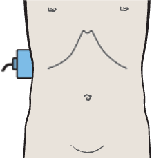 Probe position, Kidney, liver, colic flexure