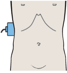Probe position, Kidney, renal vein, liver
