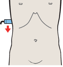 Probe position, Kidney, liver, psoas muscle, quadratus lumborum muscle