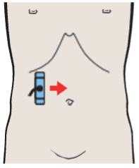 Probe position, Kidney, liver, colic flexure
