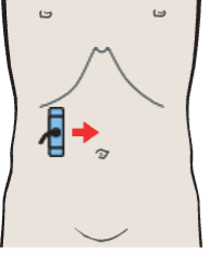 Probe position, Kidney, renal vein, colon