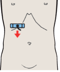 Probe position, Kidney, renal vein, vena cava, liver