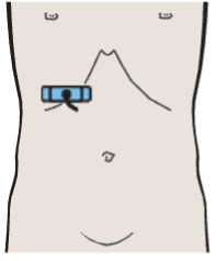 Probe position, Kidney, renal vein, renal artery, vena cava, liver