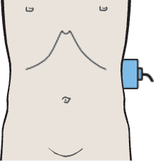 Probe position, Kidney, spleen, psoas muscle