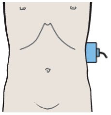 Probe position, Kidney, renal vein, spleen, aorta