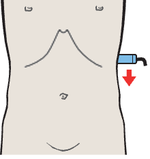 Probe position, Kidney, spleen, bowel
