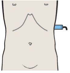 Probe position, Kidney, spleen, psoas muscle