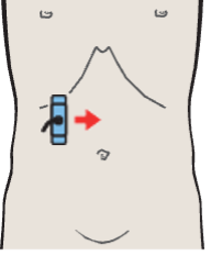Probe position, Kidney, liver