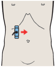 Probe position, Kidney, liver