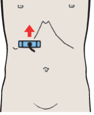 Probe position, Kidney, vena cava