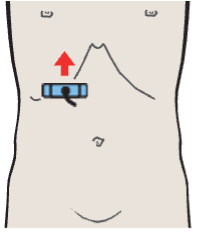 Probe position, Kidney, renal vein, vena cava
