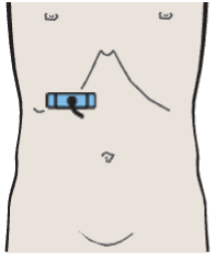 Probe position, Adrenal gland, vena cava