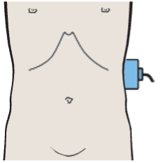 Probe position, Adrenal gland, kidney, spleen