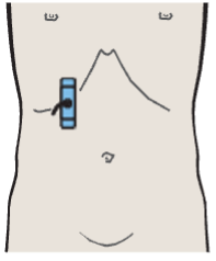 Probe position, Layers of adrenal gland