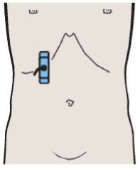Probe position, Layers of adrenal gland