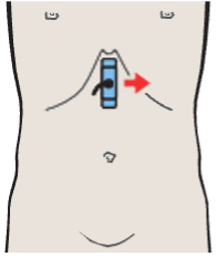 Probe position, Esophagus, aorta, liver