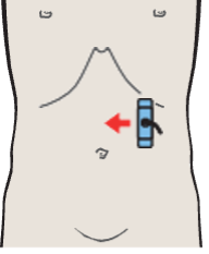 Probe position, Body of stomach, liver