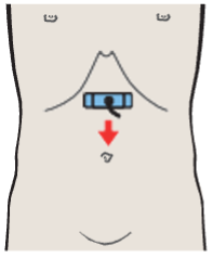 Probe position, Left gastric artery