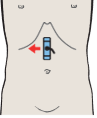 Probe position, Antrum, liver, pancreas